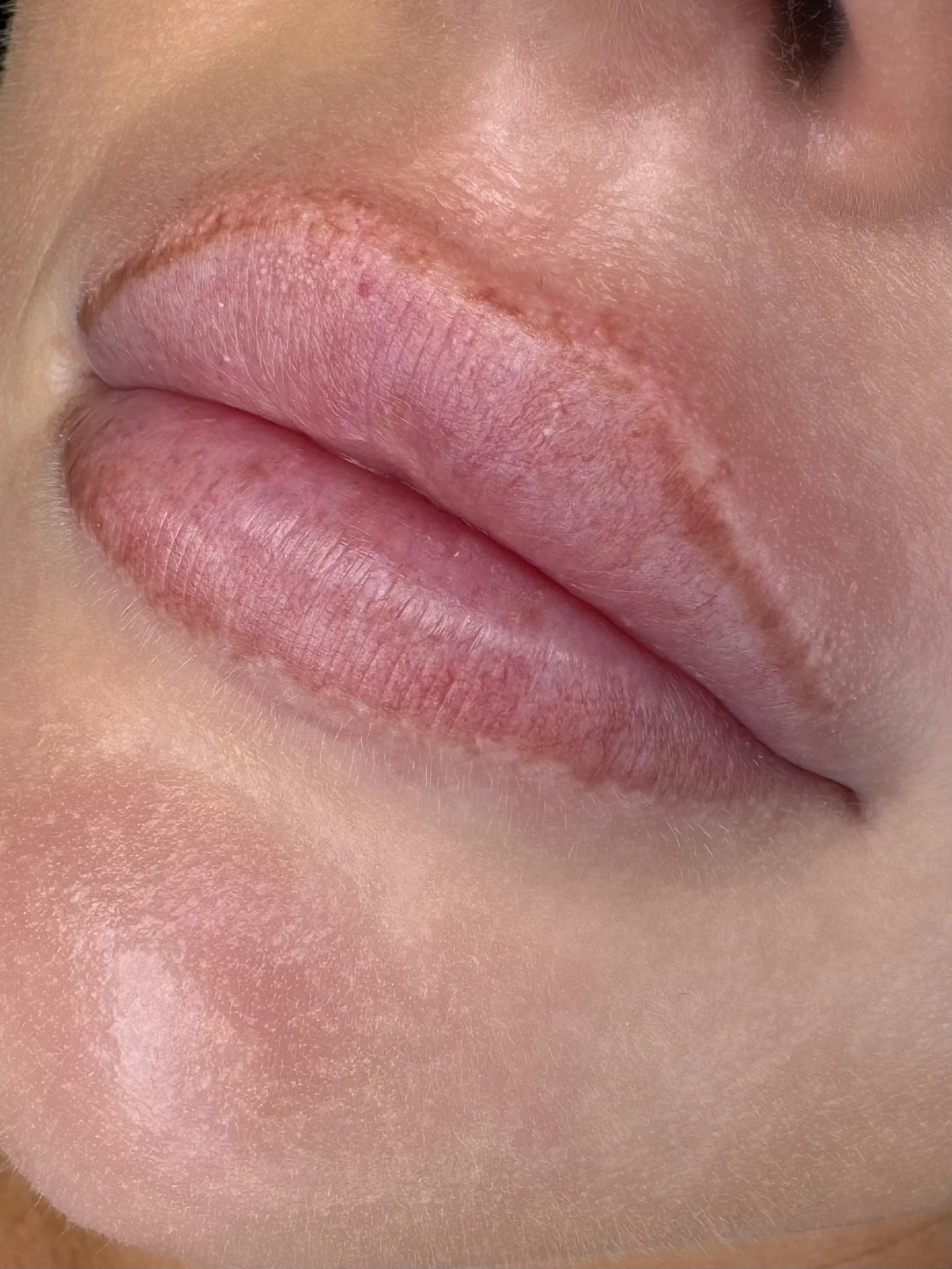 Lip Blush före behandling
