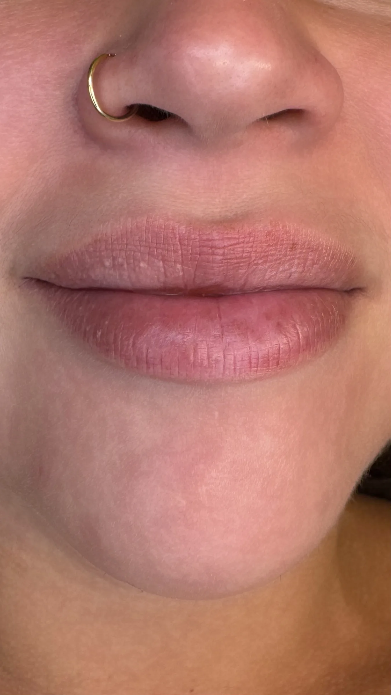 Lip Blush före behandling