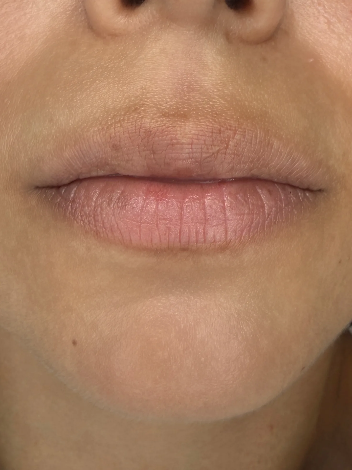 Lip Blush före behandling
